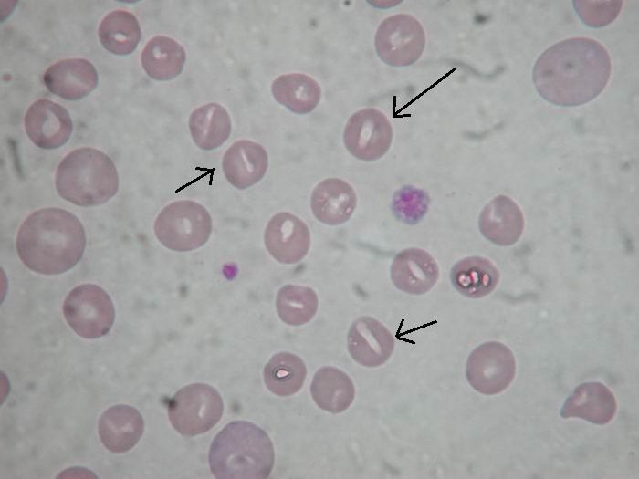 11 Stomatocyty u těchto buněk je centrální projasnění ve tvaru úst. Jelikoţ centrální bikonkavita je vytvořena jen na jedné straně.