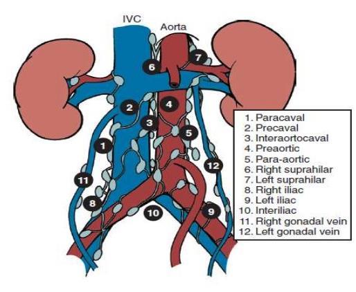 Uzliny retroperitonea - anatomie http://www.slideshare.