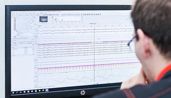 Všeobecné informace Při hospitalizaci jsou dle povahy příznaků nebo dle již známé nemoci nemocní vyšetření noční (nebo 24hodinovou) videopolysomnografií, videoelektroencefalografií, limitovanou