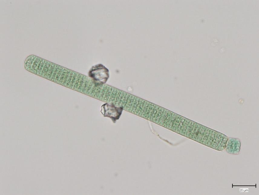 Obrazová příloha: Sinice (Cyanophyceae) Obrázek 2: Oscillatoria