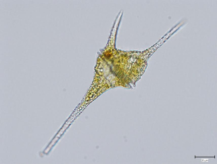 Obrněnky (Dinophycaeae)