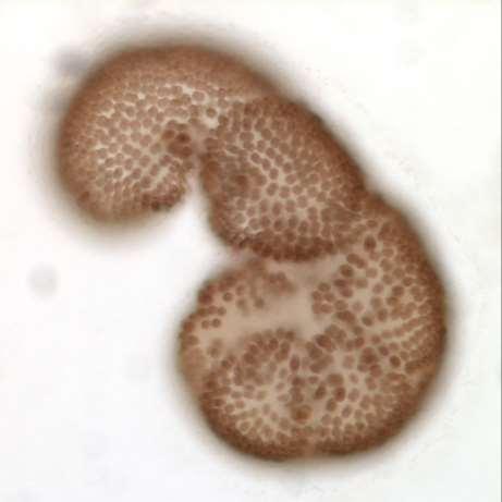 Microcystis