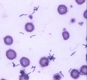 Přehled nesporulujících anaerobů (u člověka nejběžnější druhy) Koky G+ Peptococcus Peptostreptococcus