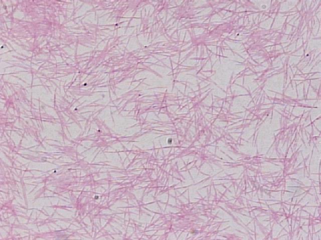 Fusobacterium sp. http://www.geocities.