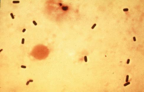 http://www.geocities.com Klostridia plynatých snětí Clostridium perfringens (nejvíce patogenní) je spolu s C. novyi, C.