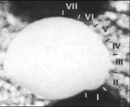 Snímky mihule Petromyzon marinus z transmisní elektronové mikroskopie ukázaly, že trabekuly vznikají z populace buněk morfologicky odlišných od ostatního mezenchymu (McBurney and Wright, 1996).