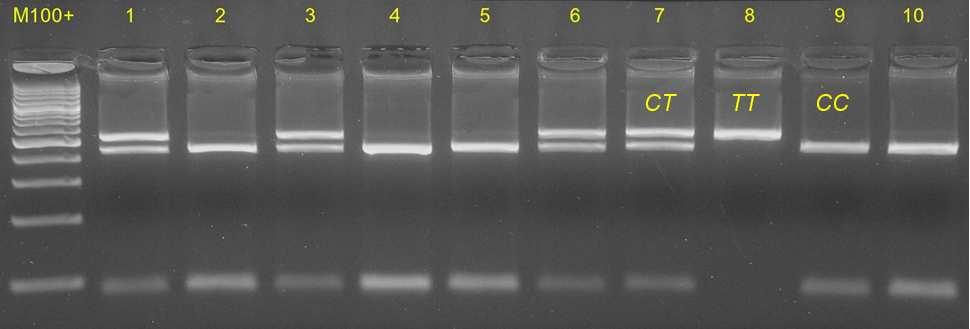 Stanovení polymorfizmu HpaII v genu NAMPT PCR produkt (524 bp) tvoří po štěpení restrikční endonukleázou HpaII dle genotypu fragmenty následujících velikostí: TT 524 bp (neobsahuje štěpné místo) CT
