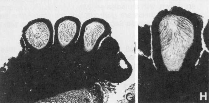 ) nebo myriothecium (polštářovitá plodnice se sestavou dutin, v každé 1 vřecko) - askolokulární houby mají pseudoapothecia, pseudoperithecia (morfologicky