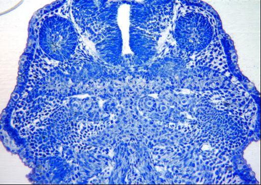 Ambystoma, stage 39 Eye MC MC In the latter stage, the teeth primordia appear in a close