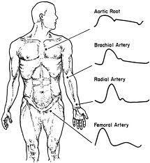 Arterialní