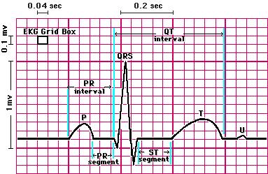 EKG