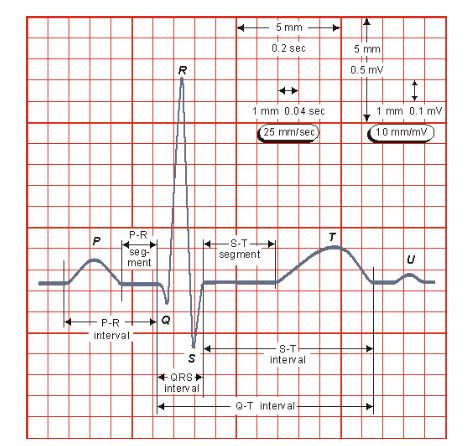 2 Elektrokardiografie Elektrokardiografie je diagnostická metoda, která je založena na snímání napětí, tvořeného elektrickým polem srdečním, z povrchu těla.