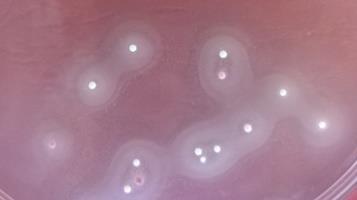 Stanovení počtu lipolytických mikroorganismů TW agar 30 C, 72 h, aerobně TW agar s želatinou a Tweenem Typické kolonie