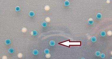 Stanovení počtu β-glukuronidázopozitivních Escherichia coli TBX agar 44 C, 18 24 h, aerobně TBX agar s tryptonem, žlučovými solemi a glukuronidem Typické kolonie β-glukuronidázopozitivních