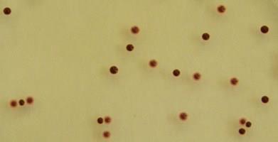 Stanovení počtu enterokoků S-B agar 37 C, 24 48 h, aerobně S-B Slanetz-Bartley agar Typické kolonie enterokoků S-B agar: kolonie červené, červenohnědé až kaštanové barvy, pravidelné,