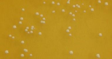 Stanovení počtu mezofilních bakterií mléčného kvašení MRS agar 30 C, 72 h, anaerobně či mikroaerofilně MRS De Man, Rogosa a Sharpe agar (ph 5,7) Typické kolonie mezofilních bakterií mléčného kvašení