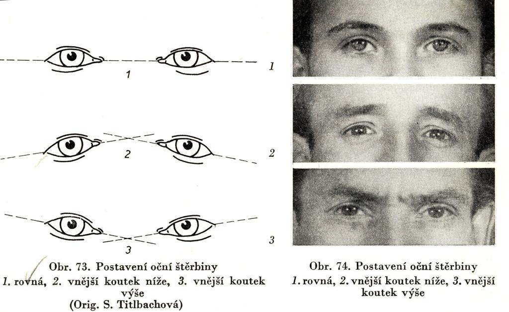 Postavení oční štěrbiny: 1. rovná, 2.