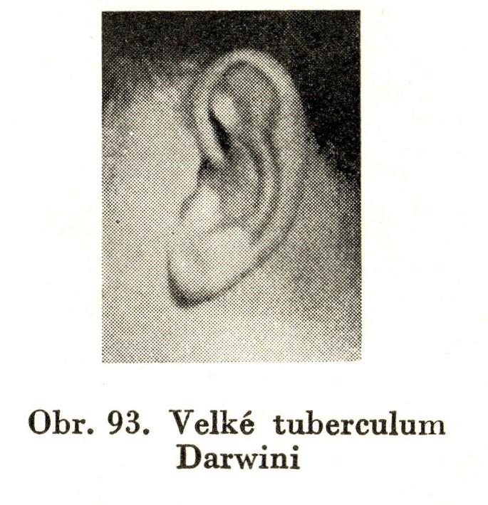 Darwinův hrbolek: zbytek původního hrotu boltce, je typický pro ušní boltec většiny primátů a)makakové