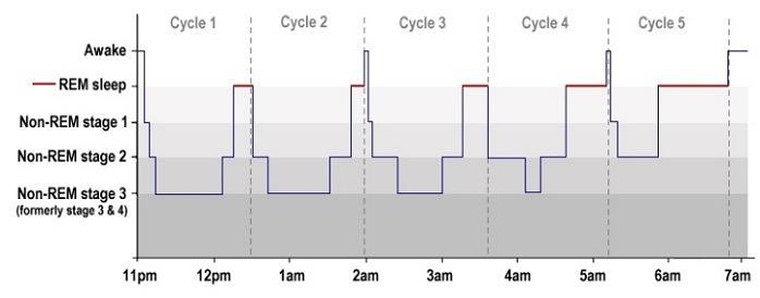 Hypnogram