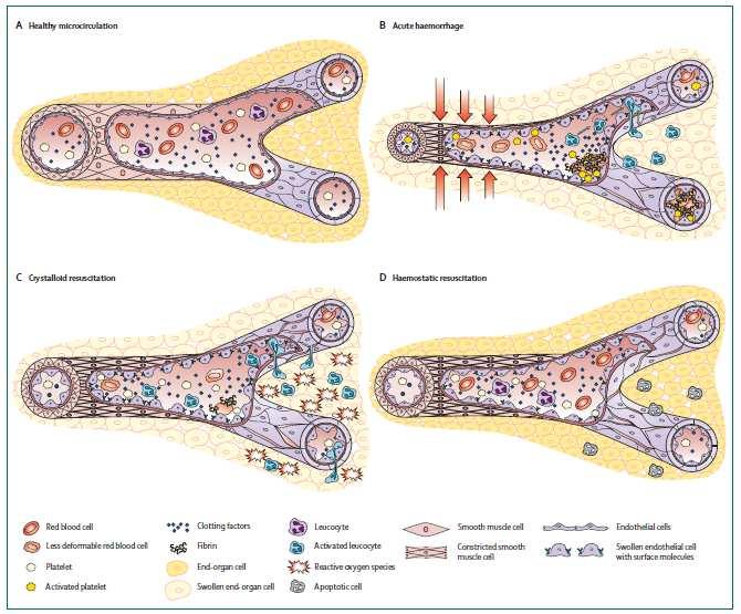 Lancet