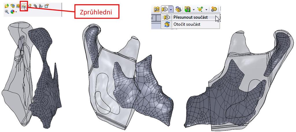 Následně pomocí příkazu "Přesunout součást" a "Otočit součást" je potřeba přemístit spongiózní kostní tkáně tak, aby respektovali fyziologické rozložení těchto tkání v dolní čelisti.