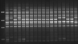 RAPD Výhody - Velmi levné - Rychlé a snadné = není třeba znát sekvenci primeru, stačí velmi málo DNA, poměrně dost