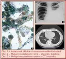 dle kapitol v