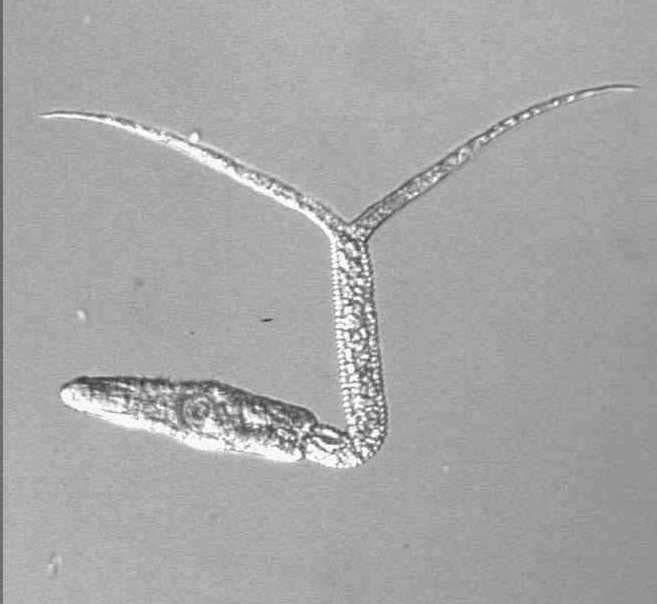 15. Fotografie cerkárie Diplostomum