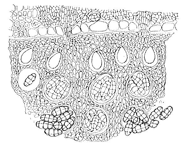 Tuberothecium uzavřená pl.