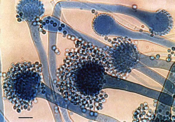 Aspergillus fumigatus vyskytuje se na celém světě, na