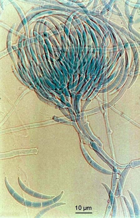Fusarium acuminatum