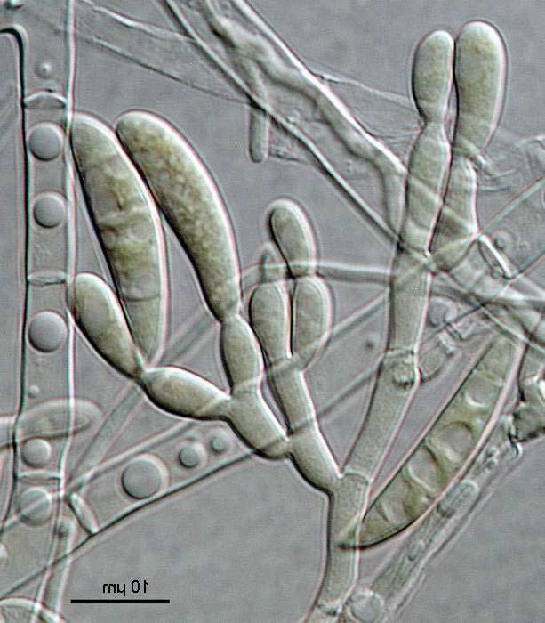 Fusarium culmorum