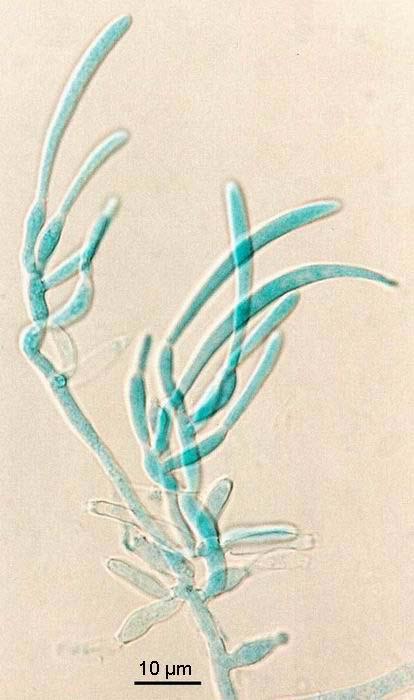 Fusarium equiseti