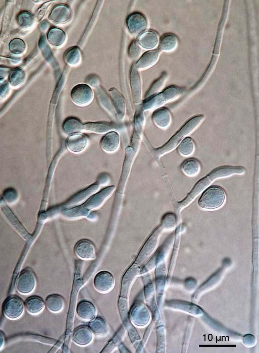 Fusarium poae mikroznaky