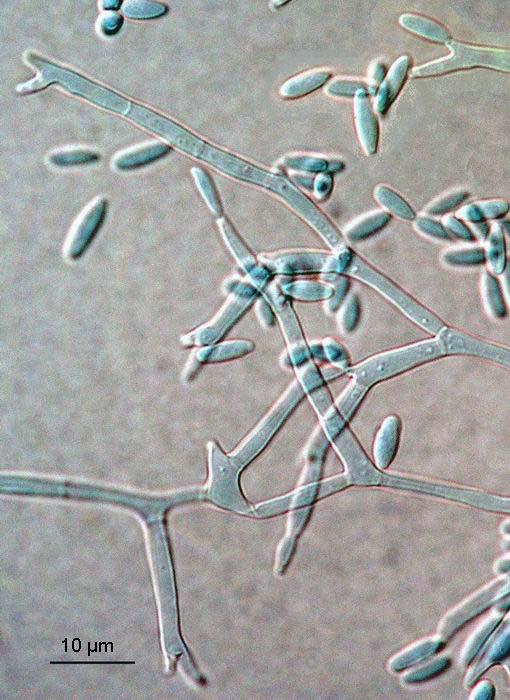 Fusarium