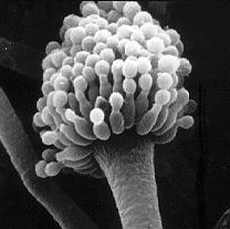 mozkové abscesy [(Fragner, 1992) uváděno pod synonymem Torulopsis glabrata]. 5.1.5. Trichosporon beigelii U člověka tvoří součást přirozené mikroflóry v plicích, játrech, dutině ústní a zvukovodu.