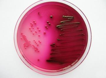 baktérie Kopřivníkov