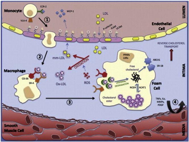 ROS A ATEROSKLEROSA LDL je oxidován makrofágy hlavní zdroj ROS NADPH oxidasa cyclooxygenasy lipoxygenasy inos myeloperoxidasa Makrofágy akumulují oxldl a jsou transformovány do pěnových buněk ROS