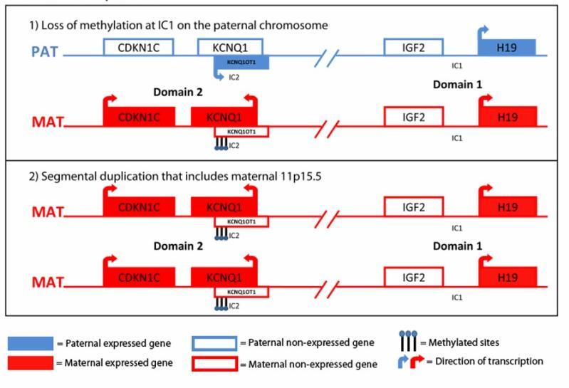 1) Ztráta methylace IC1 na paternálním chromosomu PAT CDKN1C KCNQ1 IGF2 H19 KCNQ1OT1 IC1 IC2 Doména 1 Doména 2 MAT CDKN1C KCNQ1 KCNQ1OT1 IC2 IGF2 IC1 H19 2) Částečná duplikace zahrnující maternální