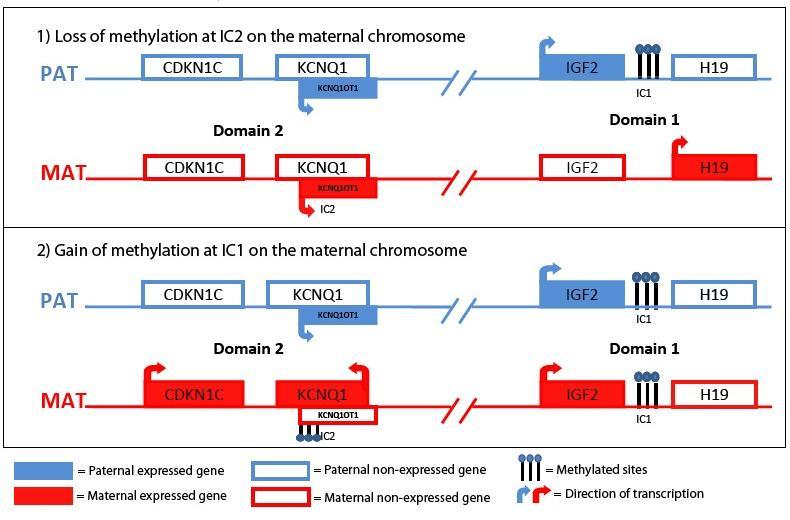 1) Ztráta methylace IC2 maternálního chromosomu PAT CDKN1C KCNQ1 KCNQ1OT1 IGF2 IC1 H19 Doména 2 Doména 1 MAT CDKN1C KCNQ1 KCNQ1OT1 IGF2 H19 IC2 2) Gain methylace IC1 na maternálním chromosomu PAT