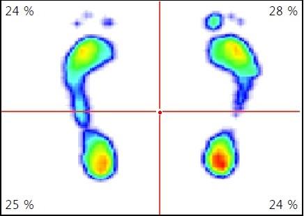 vstupní, zdroj vlastní, 2017 Příloha 2 - Footscan