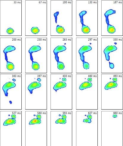 Příloha 3 - Footscan dynamický snímek