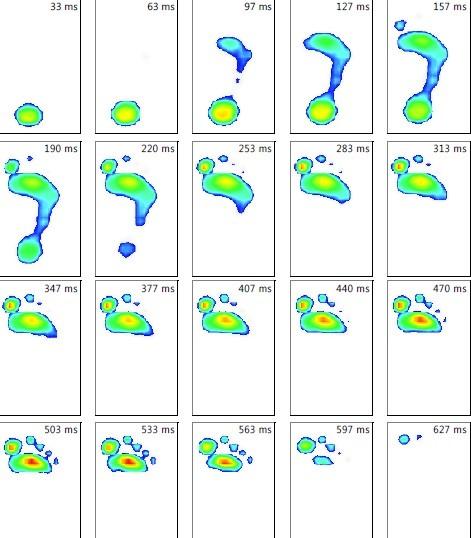 Příloha 4 - Footscan dynamický snímek