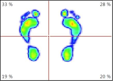 vlastní, 2017 Příloha 14 - Footscan statický