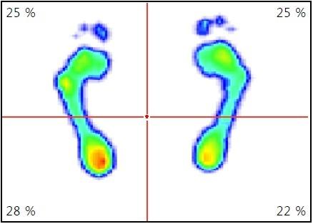 vlastní, 2017 Příloha 26 - Footscan statický