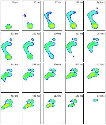 Příloha 27 - Footscan dynamický snímek