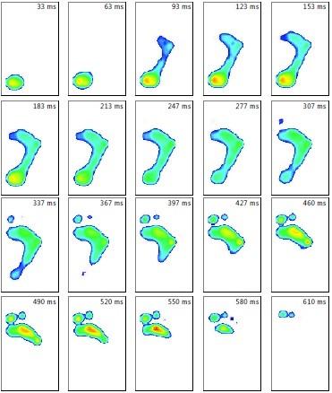 Příloha 28 - Footscan dynamický snímek