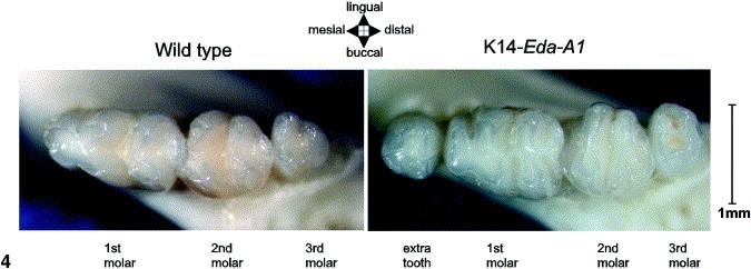 má patrně za následek pokračování vývoje a formování nadpočetného zubu (Kangas et al., 2004). Tvorba nadpočetného zubu tak jistě souvisí s navýšením Eda signalizace.