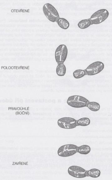 Obr. 7: Typy postavení nohou při úderu (Langerová, Heřmanová, 2005) 4.