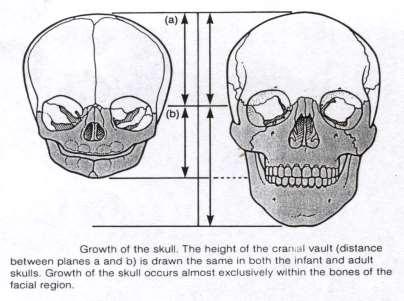 tvaru 1